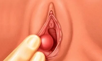 Bartholin's Cyst, Abscess, Treatment